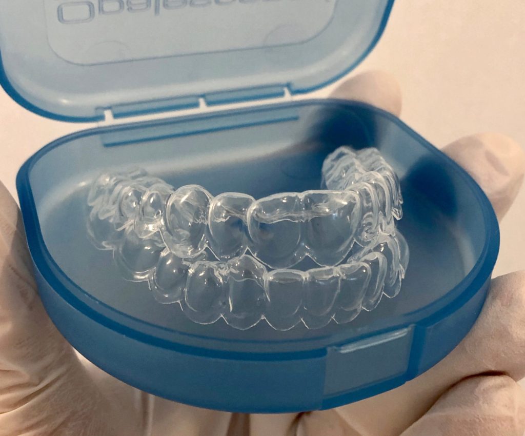 Férulas transparentes de blanqueamiento dental en un estuche azul